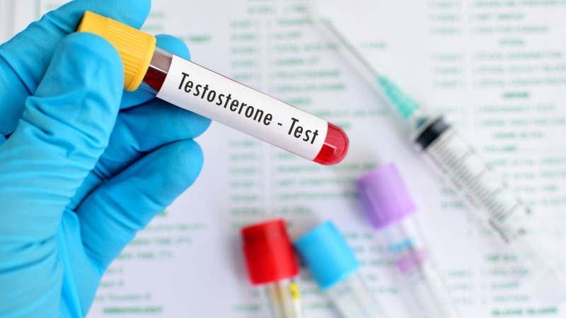 Testosterone testing